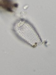 Euglypha acanthophora