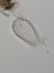 Euglypha acanthophora