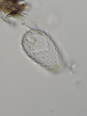 Euglypha acanthophora