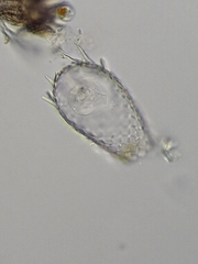 Euglypha acanthophora