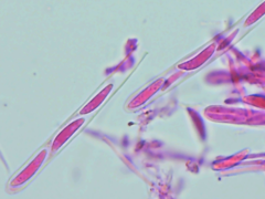 Mitrula lunulatospora