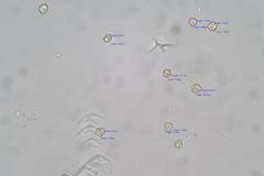 Entoloma austrorhodocalyx