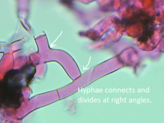 Botryobasidium vagum