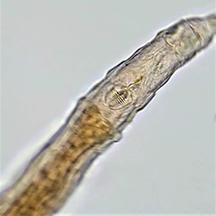 Habrotrocha collaris