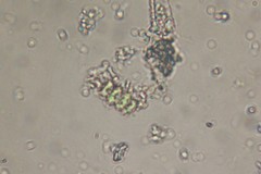 Scenedesmus