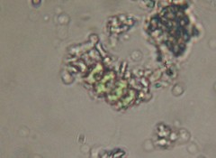 Scenedesmus