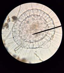 Actinosphaerium
