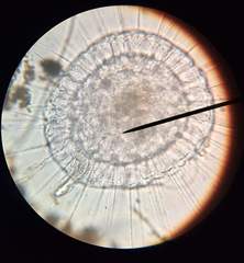 Actinosphaerium