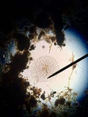 Actinosphaerium