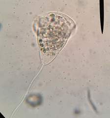 Vorticella campanula