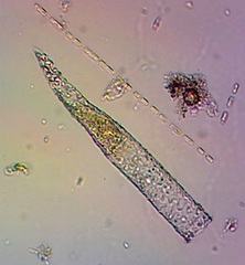 Tintinnopsis