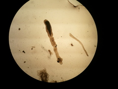 Echinococcus multilocularis