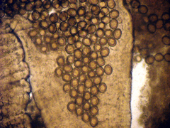 Echinococcus multilocularis