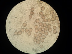 Echinococcus multilocularis