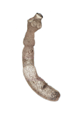 Echinococcus multilocularis