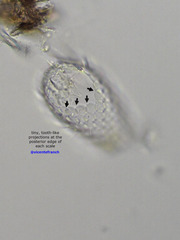 Euglypha acanthophora
