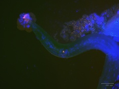 Caenorhabditis elegans