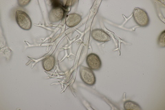 Peronospora radii