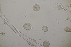 Peronospora meconopsidis