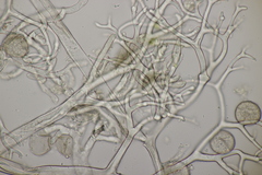 Peronospora meconopsidis