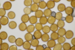 Puccinia calcitrapae