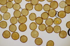 Puccinia calcitrapae