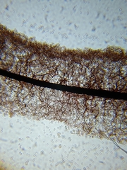 Stemonitopsis hyperopta