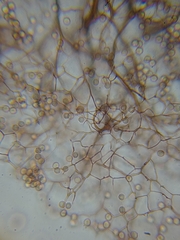 Stemonitopsis hyperopta