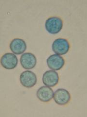 Stemonitopsis hyperopta