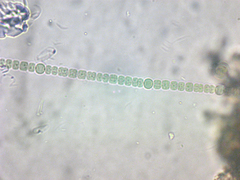 Anabaena