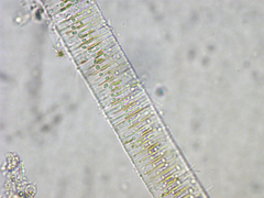 Fragilaria