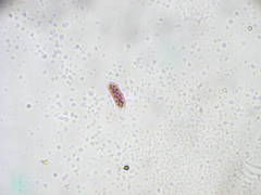 Chromatium okenii