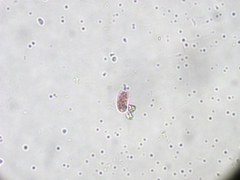 Chromatium okenii