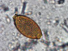 Trichuris vulpis