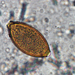 Trichuris vulpis - Photo (c) dava123, some rights reserved (CC BY-NC), uploaded by dava123