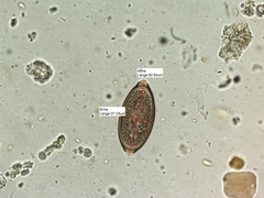 Trichuris vulpis