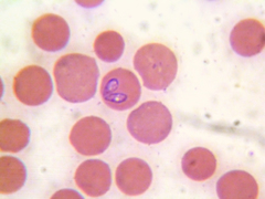 Babesia canis