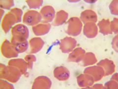 Babesia canis