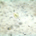 Giardia - Photo (c) dava123, some rights reserved (CC BY-NC), uploaded by dava123