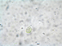 Giardia lamblia