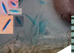 Ramularia variabilis