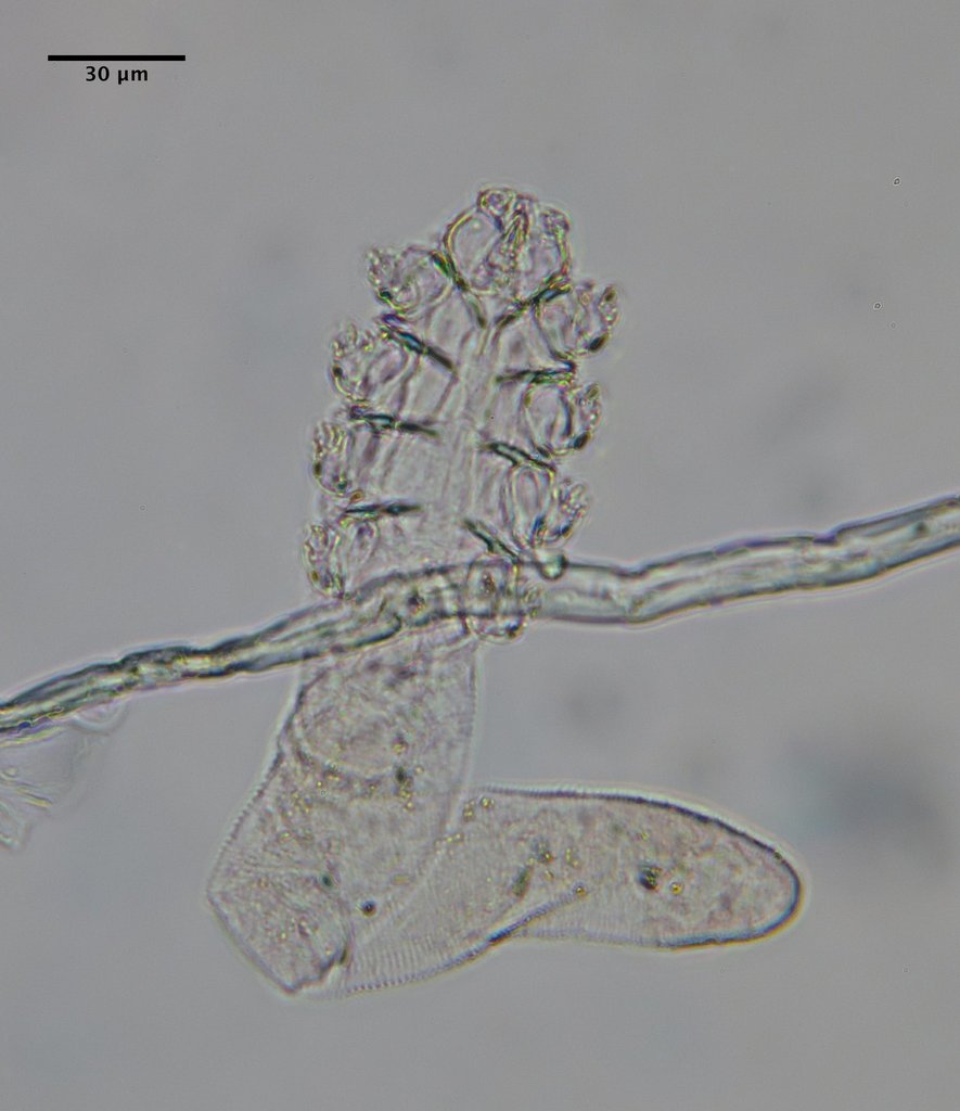 Follicle Mite