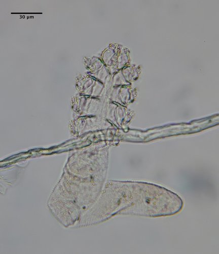 Human Follicle Mite Demodex Folliculorum · Inaturalist 