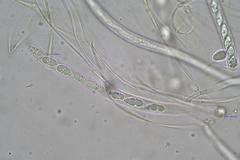 Phaeohelotium undulatum