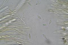 Phaeohelotium undulatum