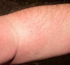 Physalis leptophylla