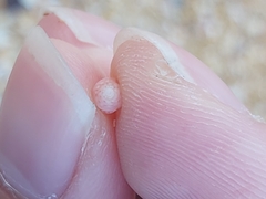 Leiopyrga lineolaris