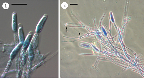 Representative image of Ichthyosporea