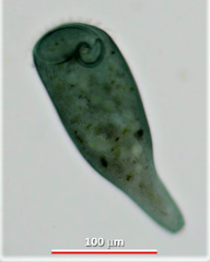 Stentor coeruleus