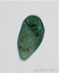 Stentor coeruleus